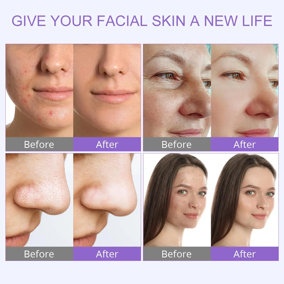 Professional Hydro Water Oxygen Jet Peel Facial Machine